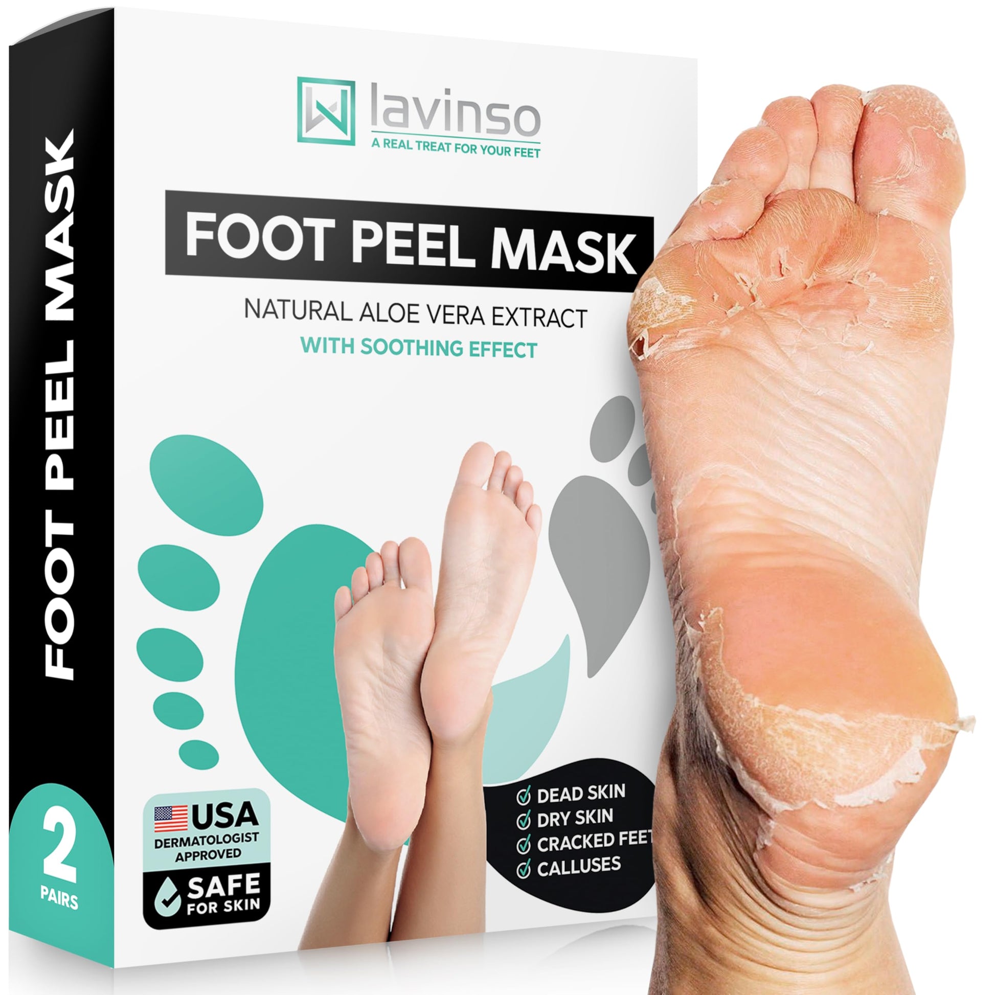 Lavinso Foot Peel Mask for Dry Cracked Feet 2 Pack Peeling Mask Removes Dead Skin and Calluses - Exfoliating for Soft Baby Feet, Original Scent